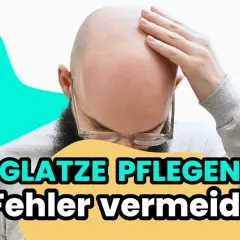 Mann mit Glatze, der sich die Stirn reibt. Text: "Glatze pflegen: 9 Fehler vermeiden".