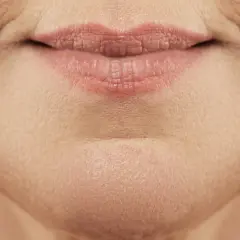 Nahaufnahme von Lippen und Kinn einer Frau, die die natürliche Hautstruktur und feine Linien zeigt, typisch für unreine Haut mit 40.