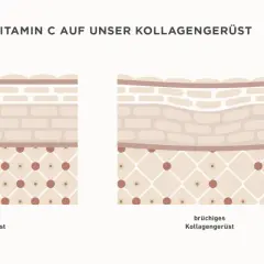 Vergleich von starkem und brüchigem Kollagengerüst der Haut. Vitamin C stärkt die Hautstruktur.