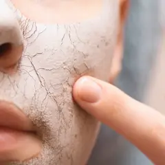 Nahaufnahme einer Maske auf dem Gesicht, die die sehr trockene Haut darunter zeigt. Ein Finger berührt die rissige Textur.