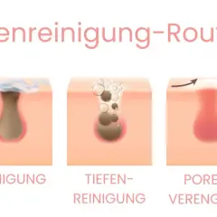 Schritt-für-Schritt-Anleitung zur Porenreinigung: Vorher sind geschlossene Mitesser sichtbar, dann Reinigung, Tiefenreinigung, Porenverengung und schließlich das Ergebnis.