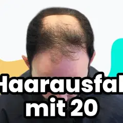 Mann mit Haarausfall mit 20 Jahren, der sich Sorgen macht.