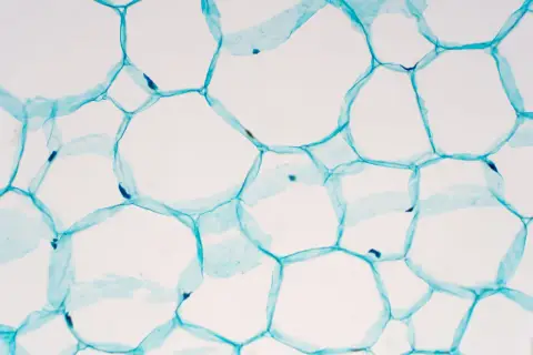 Mikroskopische Aufnahme von pflanzlichen stammzellen, die durch blaue Zellwände verbunden sind und sich zu einer wabenartigen Struktur formen.