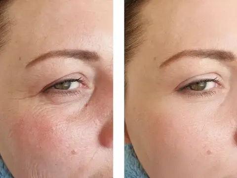Vitamin C vs. Retinol - Was ist besser für deine Haut?