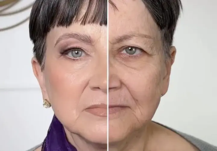 Vorher-Nachher-Vergleich: Ein Gesicht mit und ohne Make-up, das extreme Schlupflider zeigt.