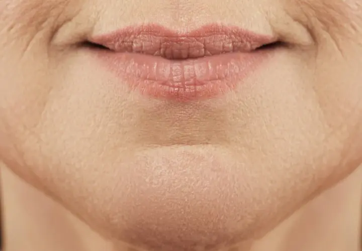 Nahaufnahme von Lippen und Kinn einer Frau, die die natürliche Hautstruktur und feine Linien zeigt, typisch für unreine Haut mit 40.