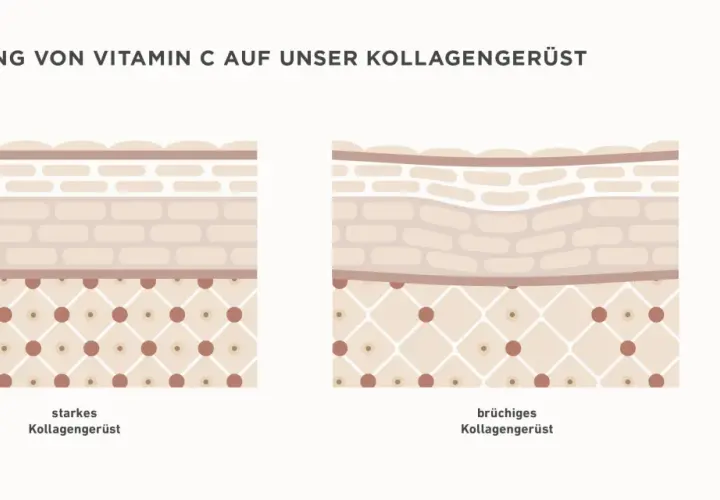 Vergleich von starkem und brüchigem Kollagengerüst der Haut. Vitamin C stärkt die Hautstruktur.