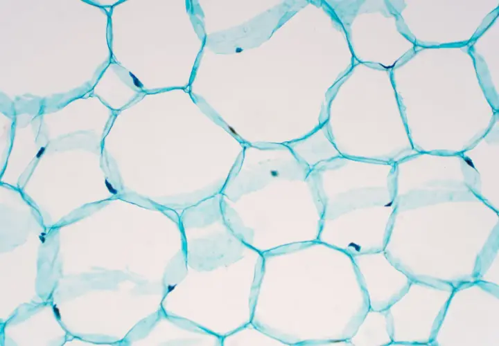 Mikroskopische Aufnahme von pflanzlichen stammzellen, die durch blaue Zellwände verbunden sind und sich zu einer wabenartigen Struktur formen.