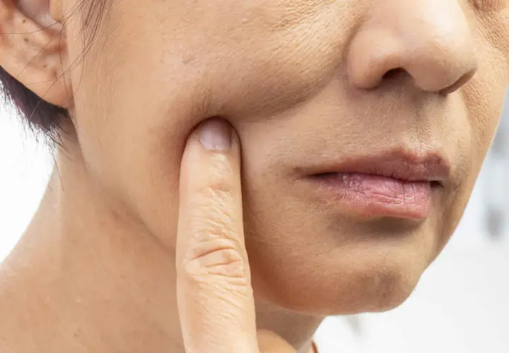 Nahaufnahme einer Frau, die mit dem Finger auf ihre Wange tippt. Die Haut zeigt Falten und Pigmentflecken, Anzeichen von **Hautalterung durch Sonne**.