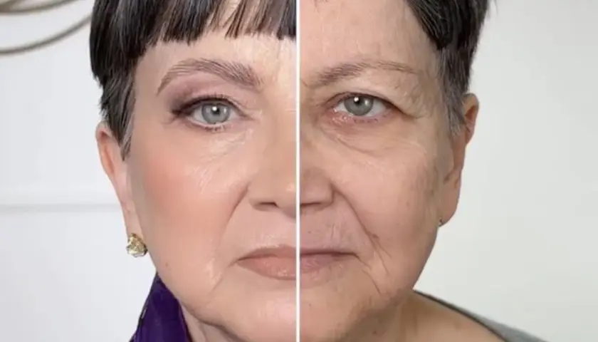 Vorher-Nachher-Vergleich: Ein Gesicht mit und ohne Make-up, das extreme Schlupflider zeigt.