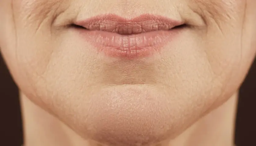 Nahaufnahme von Lippen und Kinn einer Frau, die die natürliche Hautstruktur und feine Linien zeigt, typisch für unreine Haut mit 40.