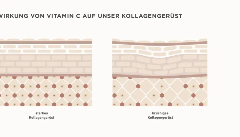 Vergleich von starkem und brüchigem Kollagengerüst der Haut. Vitamin C stärkt die Hautstruktur.