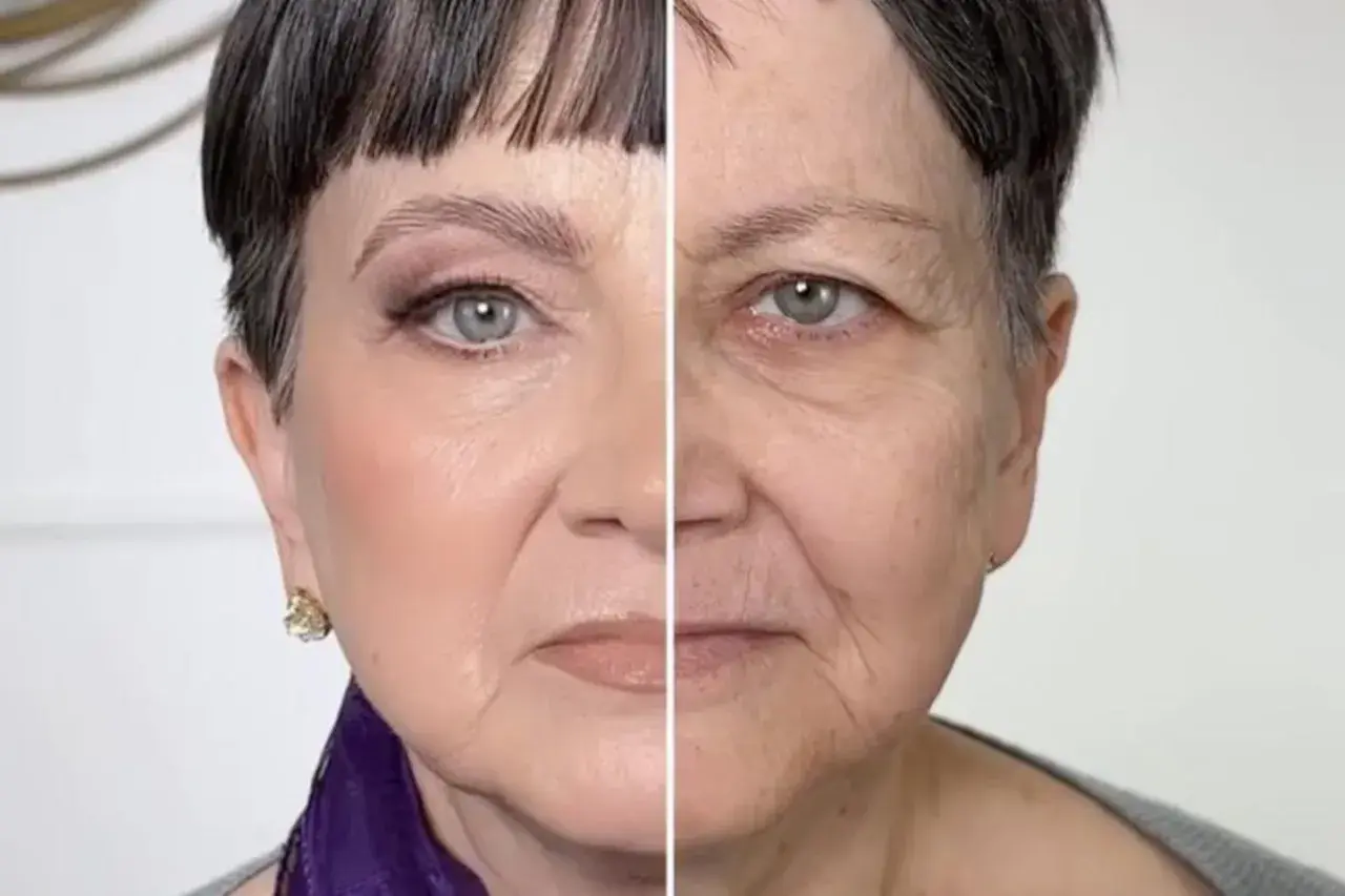 Vorher-Nachher-Vergleich: Ein Gesicht mit und ohne Make-up, das extreme Schlupflider zeigt.