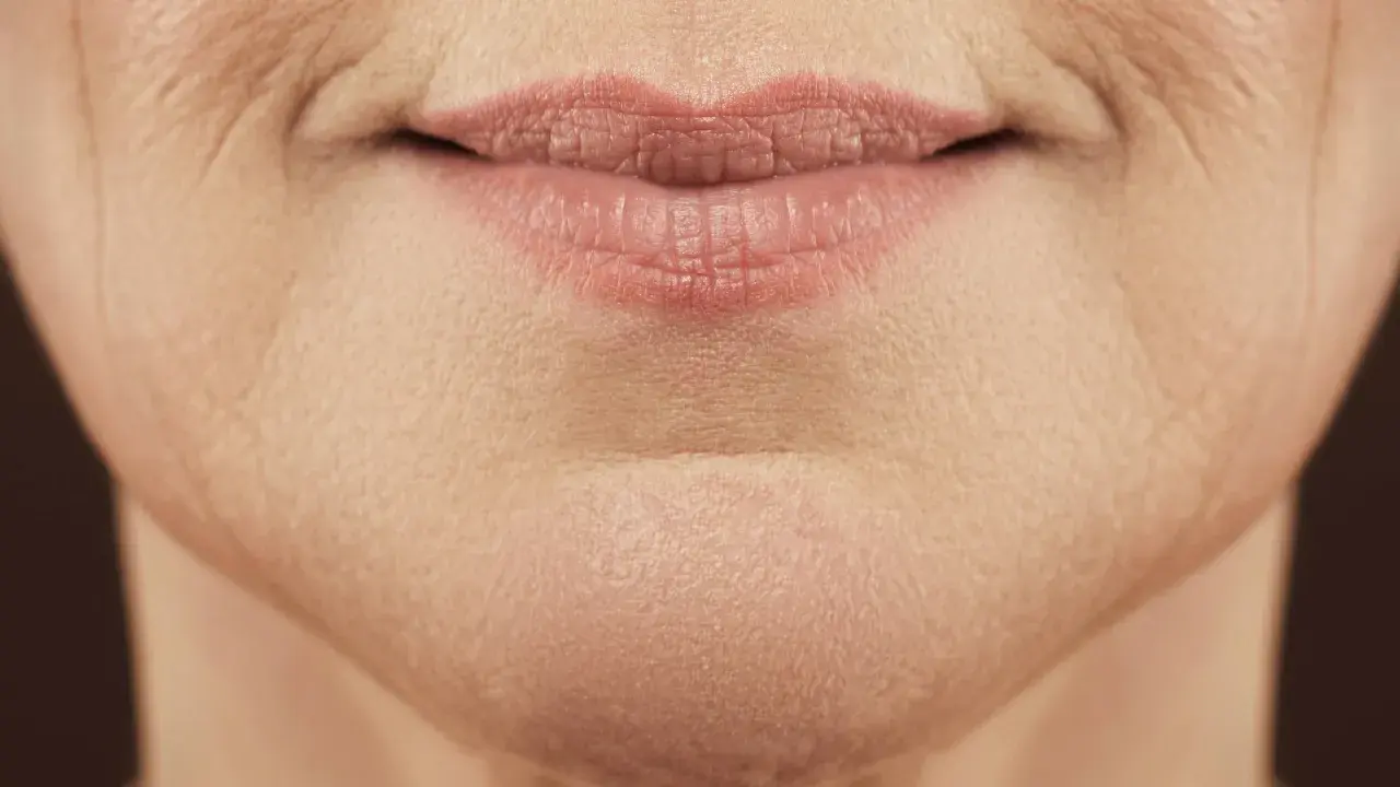 Nahaufnahme von Lippen und Kinn einer Frau, die die natürliche Hautstruktur und feine Linien zeigt, typisch für unreine Haut mit 40.