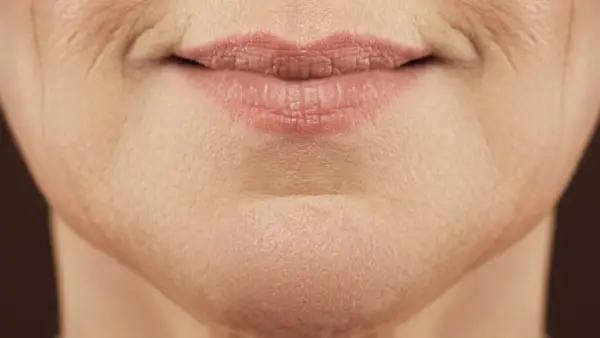 Nahaufnahme von Lippen und Kinn einer Frau, die die natürliche Hautstruktur und feine Linien zeigt, typisch für unreine Haut mit 40.